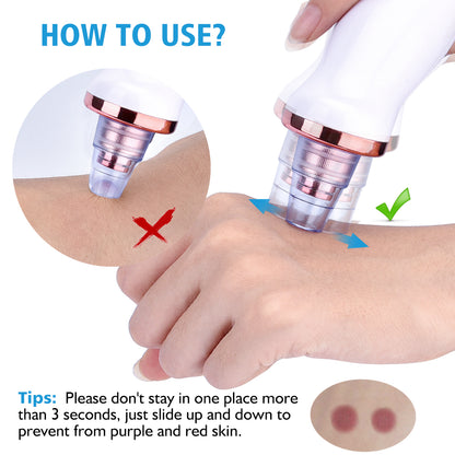 Poreva pore vacuum blackhead remover - product photo 4 - AVALDEY