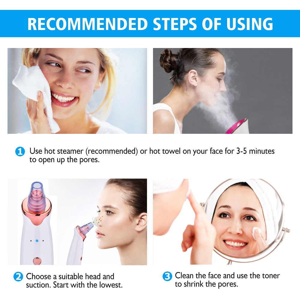 Poreva pore vacuum blackhead remover - product photo 2 - AVALDEY